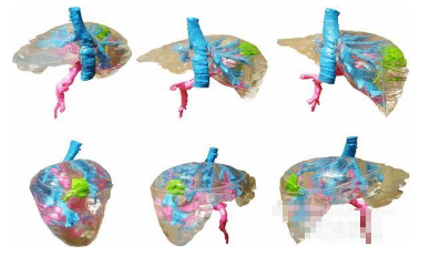 波蘭創(chuàng)建低成本彩色肝臟<a href=http://ynbfy.com/dayin.html target=_blank class=infotextkey>3D打印模型</a>