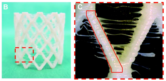 科學家展示可生物降解的自擴展3D打印支架